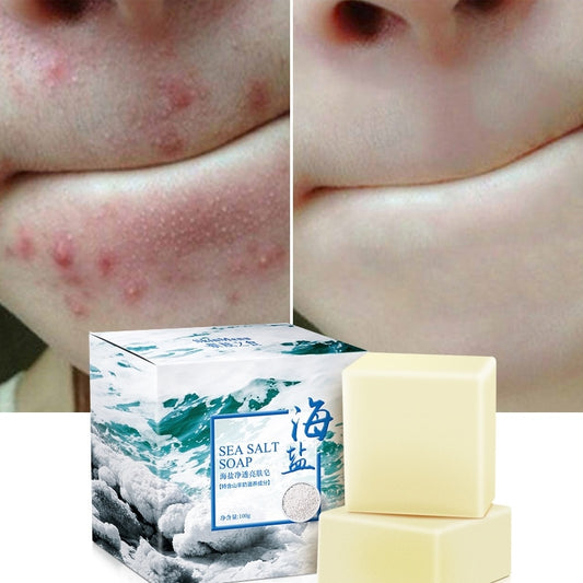 Natural Sea Salt Soap – Skin Brightening & Moisturizing Face and Body Care